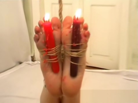 Todo arreglado y candle Wax Burns Los pies
